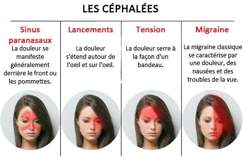 Types de céphalées